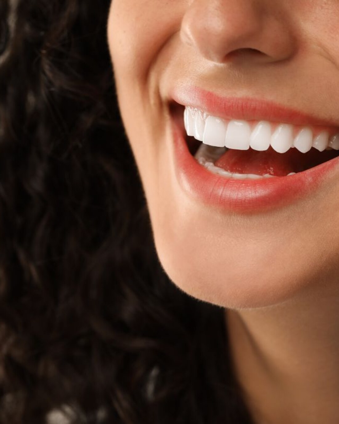 Woman smiling with bright white teeth after cosmetic dentistry at Inova Dental Clinic in Sterling, VA