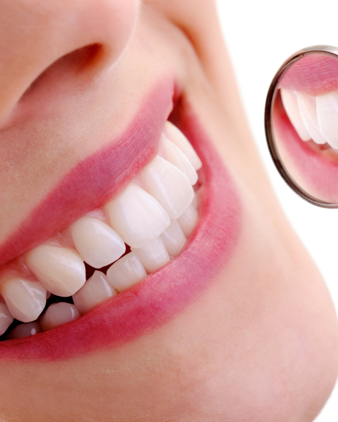 Healthy white smile and smile makeover results at Inova Dental Clinic in Sterling, VA
