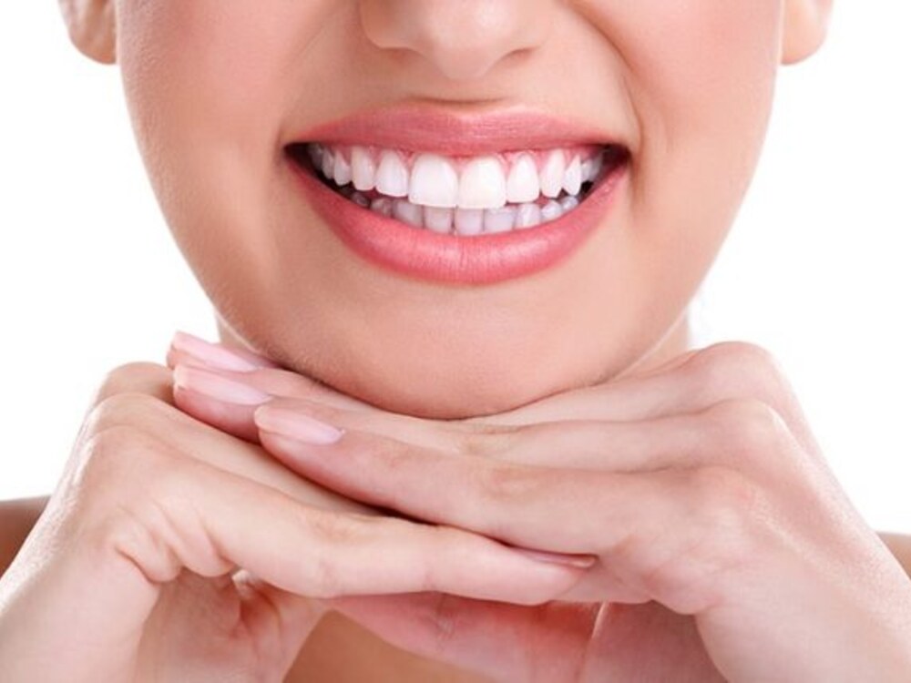 Close-up of a bright white smile after professional teeth whitening in Sterling, VA